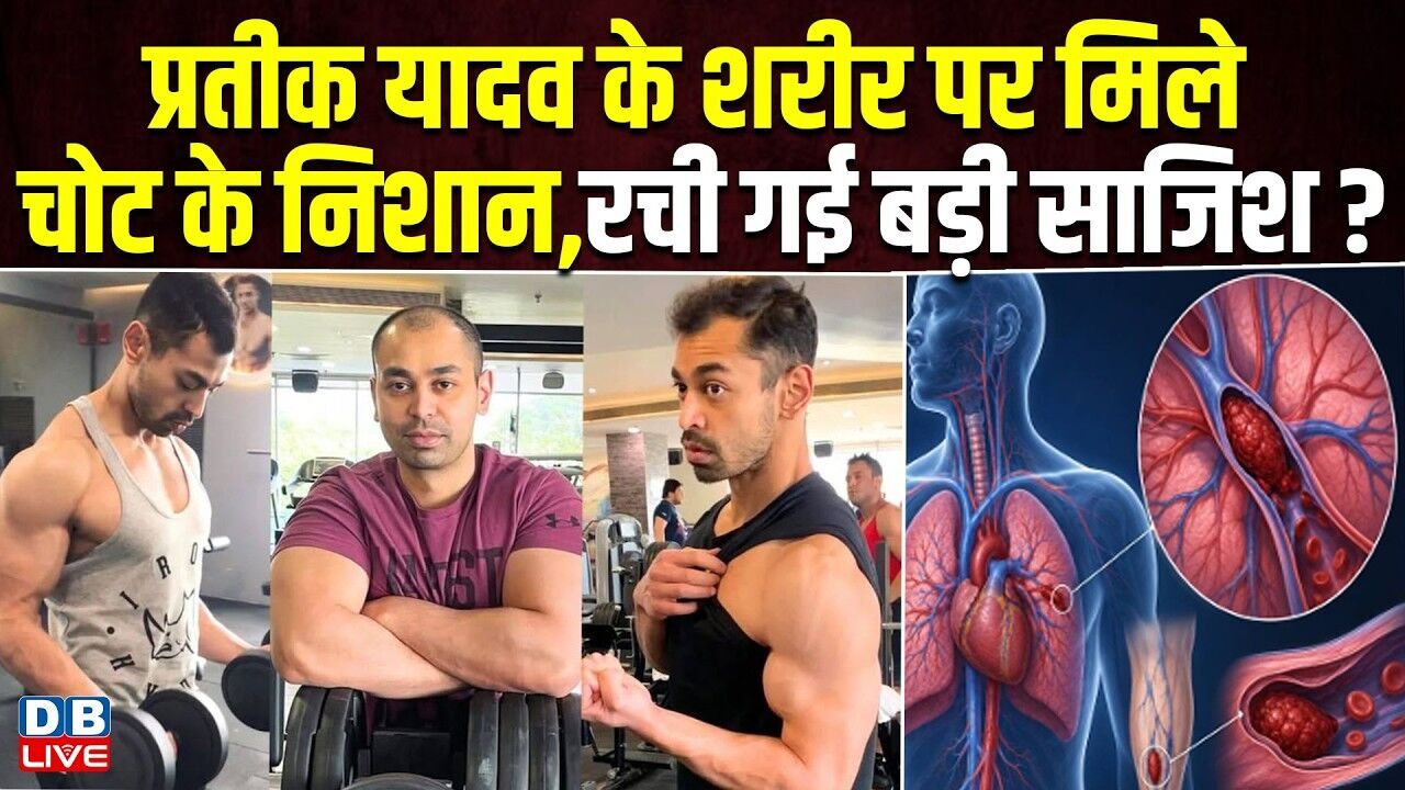 प्रतीक यादव के शरीर पर मिले चोट के निशान रची गई बड़ी साजिश? pradeep yadav news | #dblive